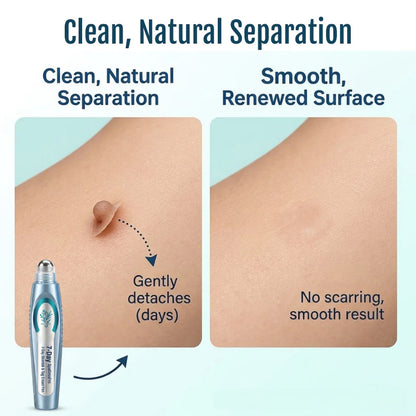 vellarocare® 7-Day Skin Tag & Blemish Repair Pen—a painless, scar-free, and highly effective blemish-removal roller pen.