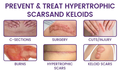 🔥 LIMITED SPECIAL OFFER Grunsify Scar Repair Gel