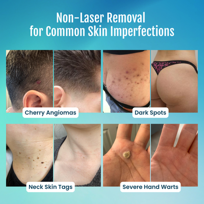 vellarocare® 7-Day Skin Tag & Blemish Repair Pen—a painless, scar-free, and highly effective blemish-removal roller pen.