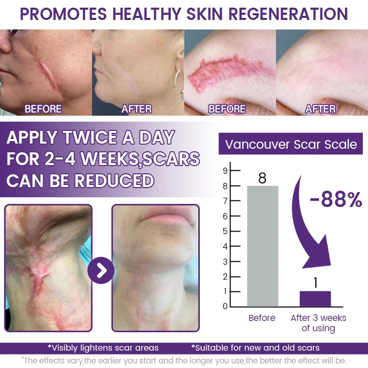 🔥 LIMITED SPECIAL OFFER Grunsify Scar Repair Gel