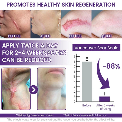 🔥 LIMITED SPECIAL OFFER Grunsify Scar Repair Gel