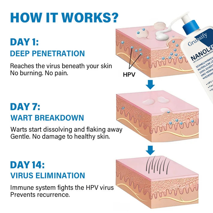 Grunsify NanoLipo HPV Genital Warts Eraser Cream Plus+