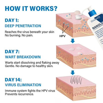 Grunsify NanoLipo HPV Genital Warts Eraser Cream Plus+